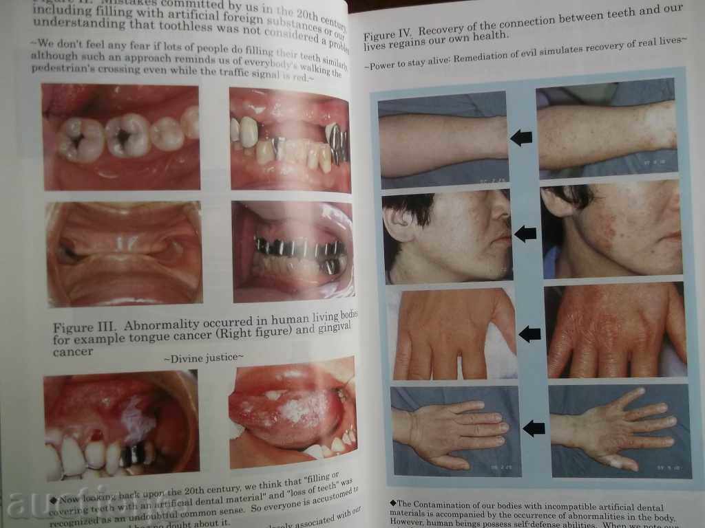 Teeth are Our Organs - Kazumasa Muratsu 2009 Dentistry with price 80.00 BGN | € 40.90 Teeth are Our Organs - Kazumasa Muratsu 2009 Dentistry with price 80.00 BGN | € 40.90