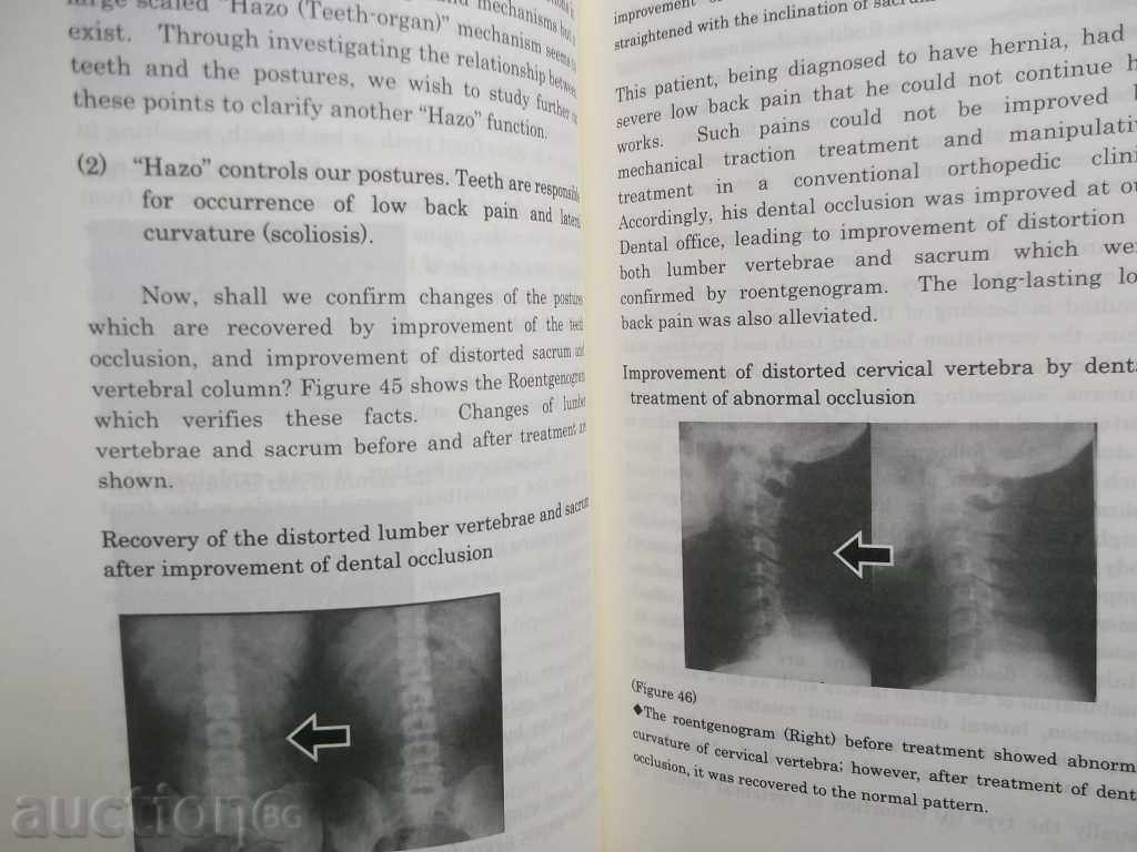 Auction Teeth are Our Organs - Kazumasa Muratsu 2009 Dentistry Auction Teeth are Our Organs - Kazumasa Muratsu 2009 Dentistry