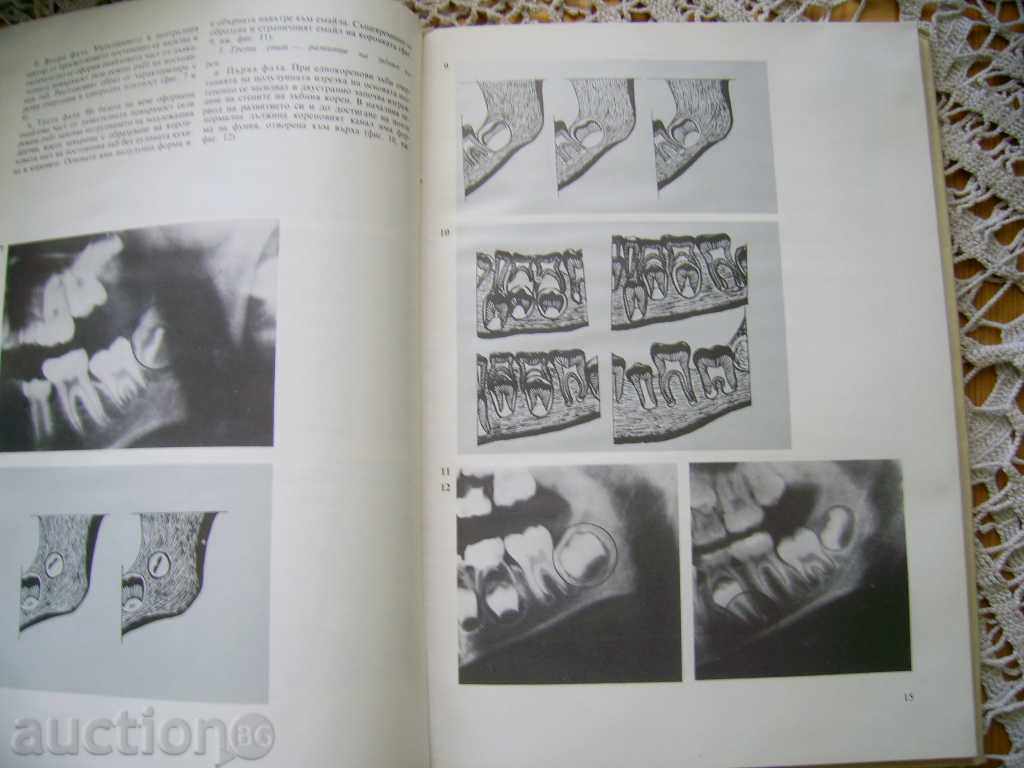 Dimitar Madjarov: Atlas of Dental Radiology with price 20.00 BGN | € 10.23 Dimitar Madjarov: Atlas of Dental Radiology with price 20.00 BGN | € 10.23