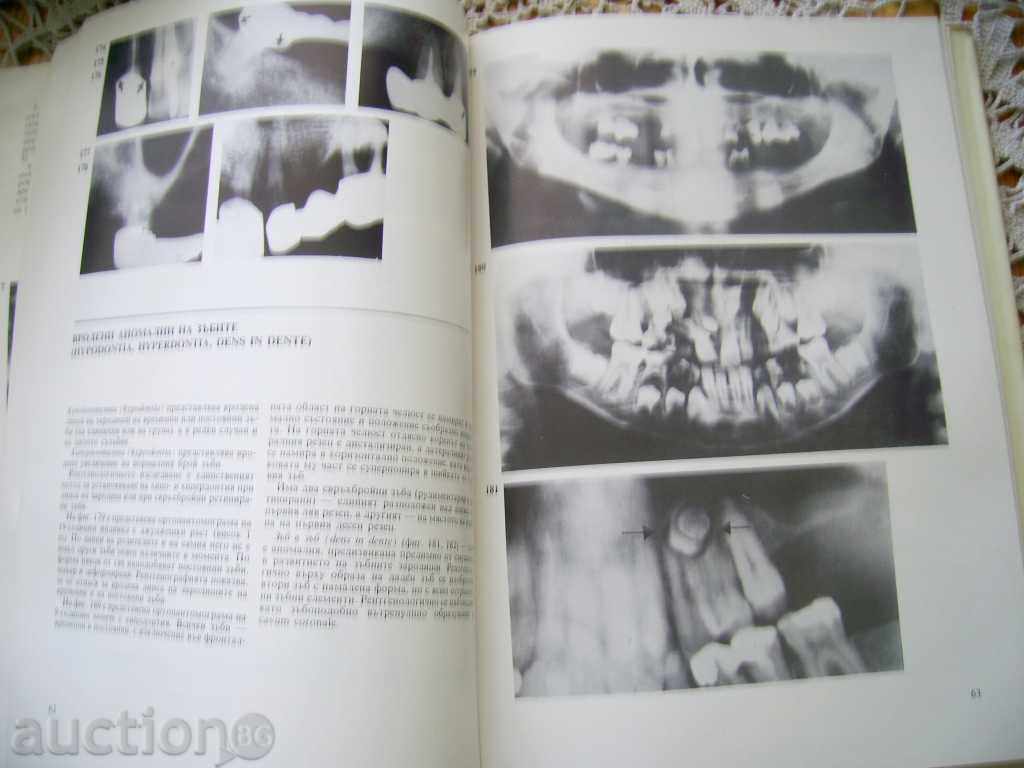 Auction Dimitar Madjarov: Atlas of Dental Radiology Auction Dimitar Madjarov: Atlas of Dental Radiology