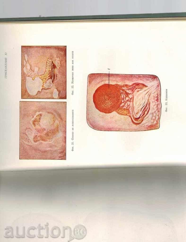Auction ONCOLOGY MANAGEMENT THOM 2 - G. TENCHOV AND OTHERS. / 1955 D. / Auction ONCOLOGY MANAGEMENT THOM 2 - G. TENCHOV AND OTHERS. / 1955 D. /