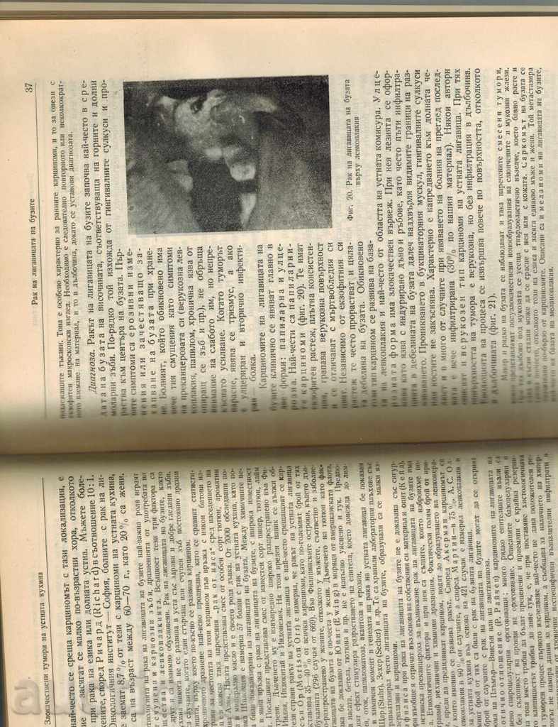 ONCOLOGY MANAGEMENT THOM 2 - G. TENCHOV AND OTHERS. / 1955 D. / - 5 ONCOLOGY MANAGEMENT THOM 2 - G. TENCHOV AND OTHERS. / 1955 D. / - 5