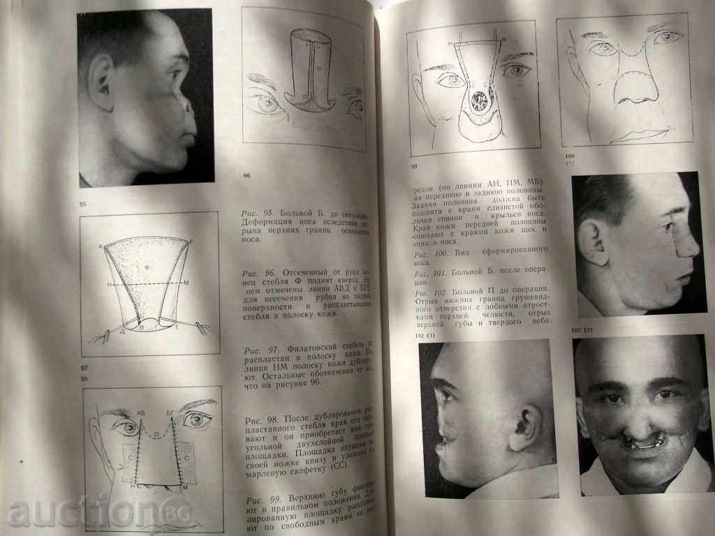 Auction Atlas Plastic Surgery Faces and Shea Auction Atlas Plastic Surgery Faces and Shea