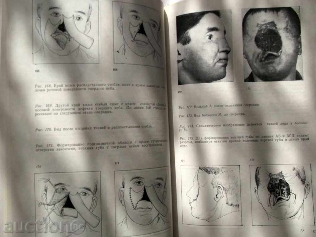 Delivery of Atlas Plastic Surgery Faces and Shea Delivery of Atlas Plastic Surgery Faces and Shea