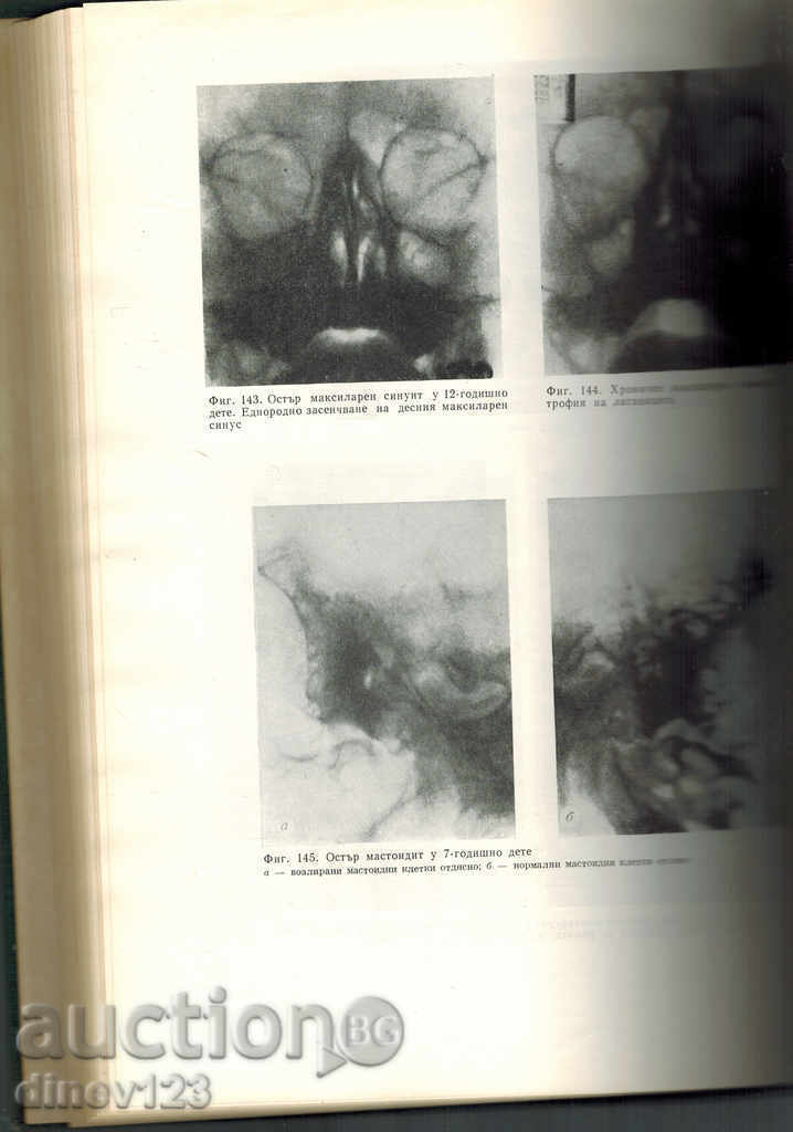 Auction RENGTH DIAGNOSTICS IN CHILD AGE Auction RENGTH DIAGNOSTICS IN CHILD AGE