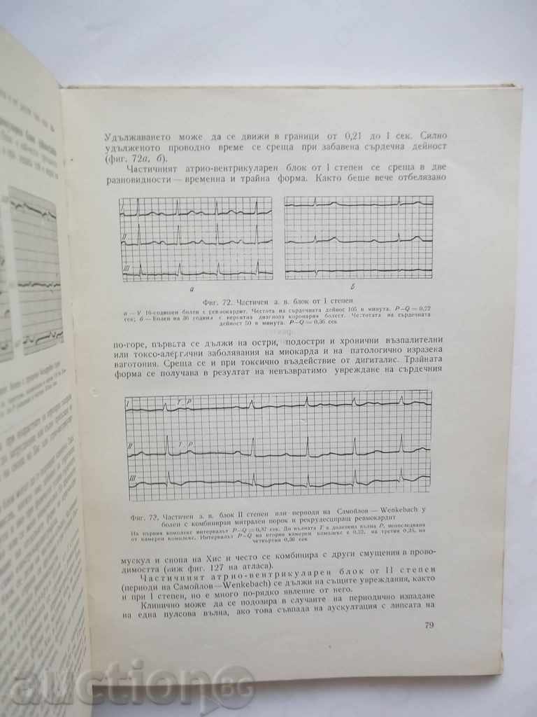 Licitație atlas electrocardiografe practice - A. MITOV 1964 Licitație atlas electrocardiografe practice - A. MITOV 1964