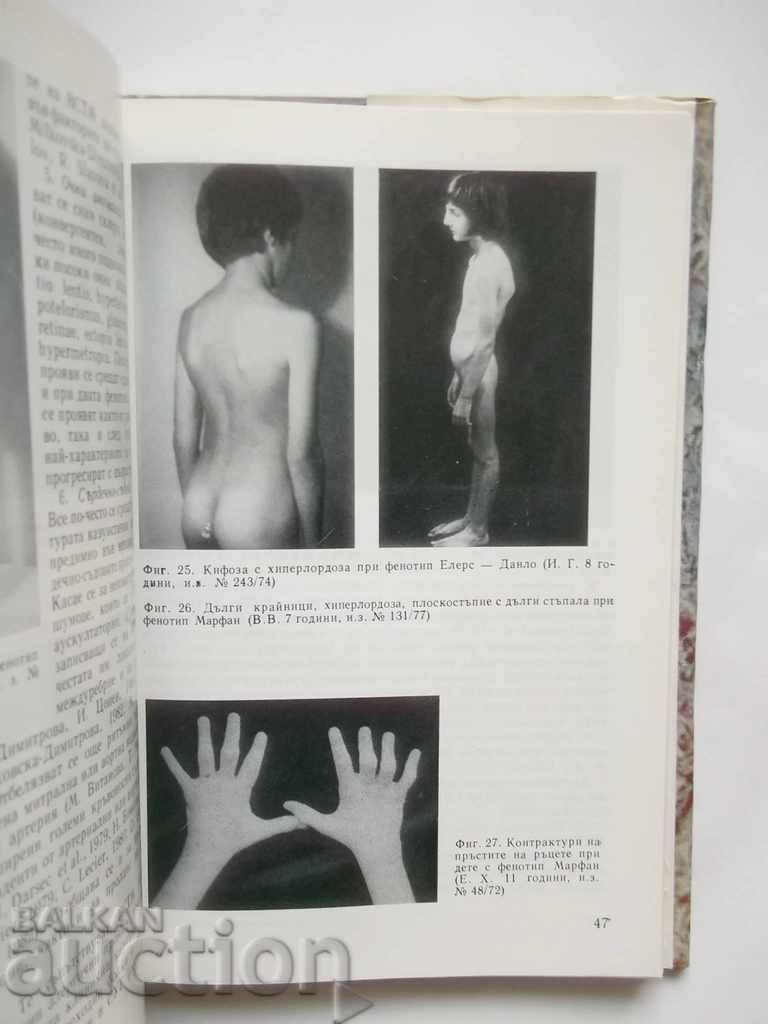 Licitație malostoynost conjunctiv congenitale la copii 1987 Licitație malostoynost conjunctiv congenitale la copii 1987