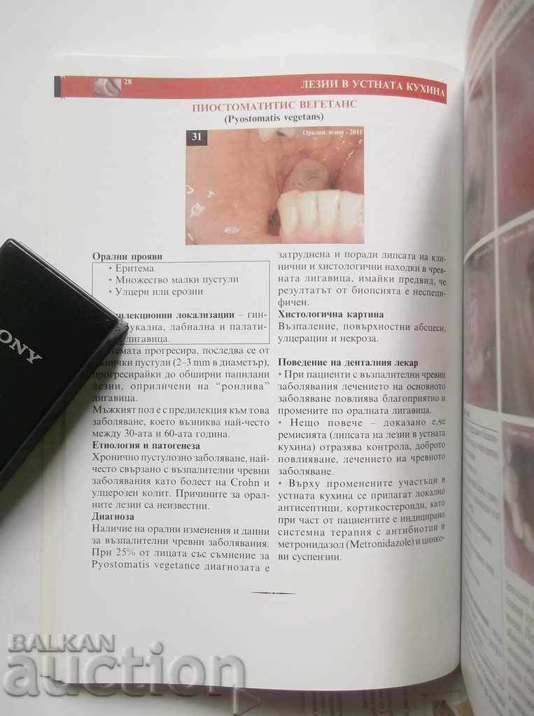 Licitație Leziuni orale - A. Krasteva și alții. 2011 Medicina dentara Licitație Leziuni orale - A. Krasteva și alții. 2011 Medicina dentara