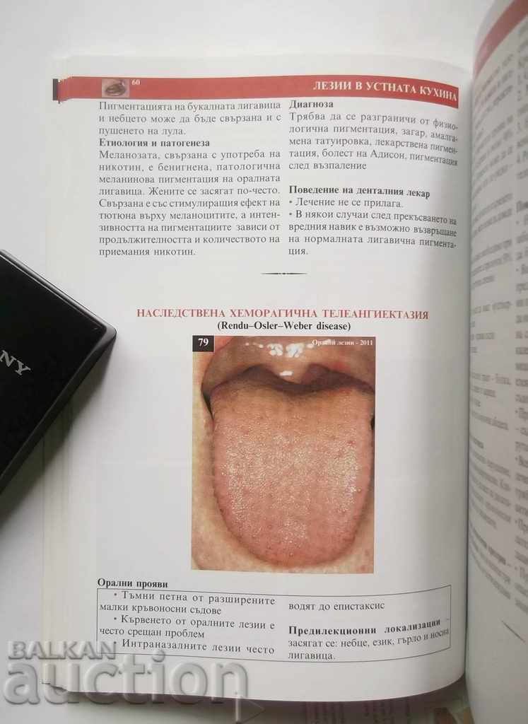 Leziuni orale - A. Krasteva și alții. 2011 Medicina dentara - 5 Leziuni orale - A. Krasteva și alții. 2011 Medicina dentara - 5