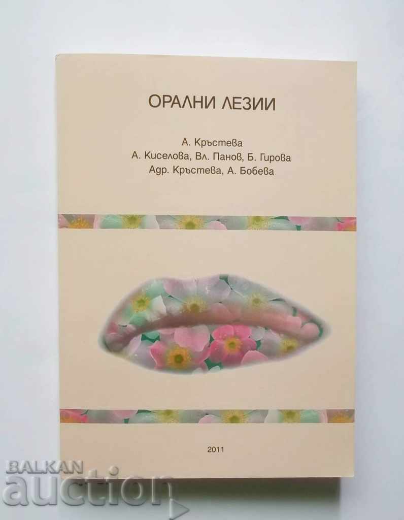 Leziuni orale - A. Krasteva și alții. 2011 Medicina dentara