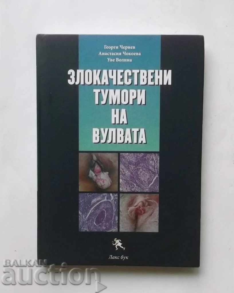 Malignant tumors of the vulva - Georgi Chernev and others. 2015