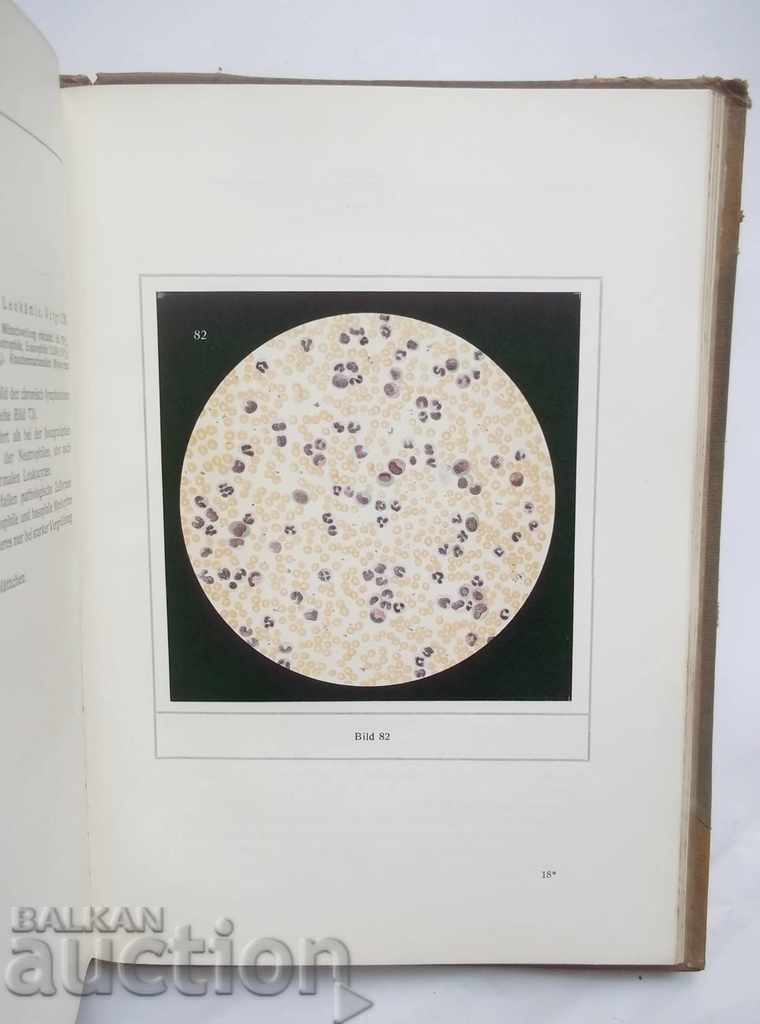 Δημοπρασία Atlas der Blutkrankheiten - Karl Schleip, Albert Alder 1928