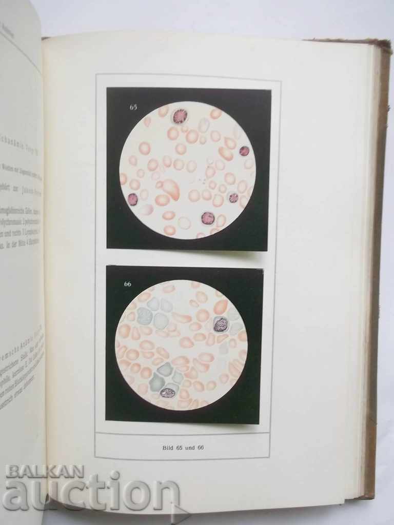 Παράδοση Atlas der Blutkrankheiten - Karl Schleip, Albert Alder 1928