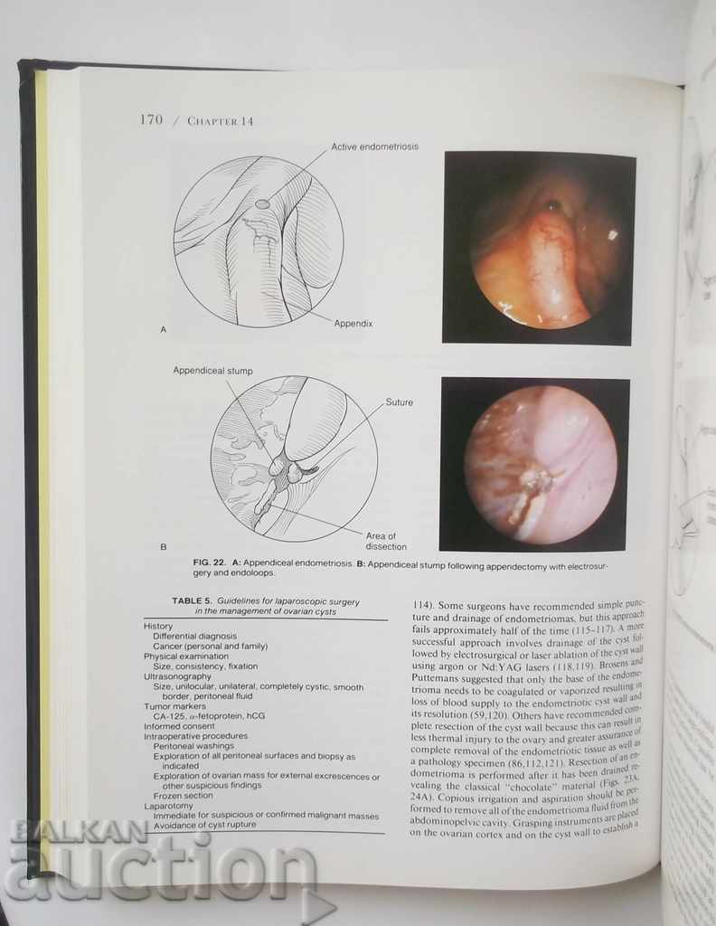 Endoscopic Management of Gynecologic Disease 1996 г. - 5 Endoscopic Management of Gynecologic Disease 1996 г. - 5