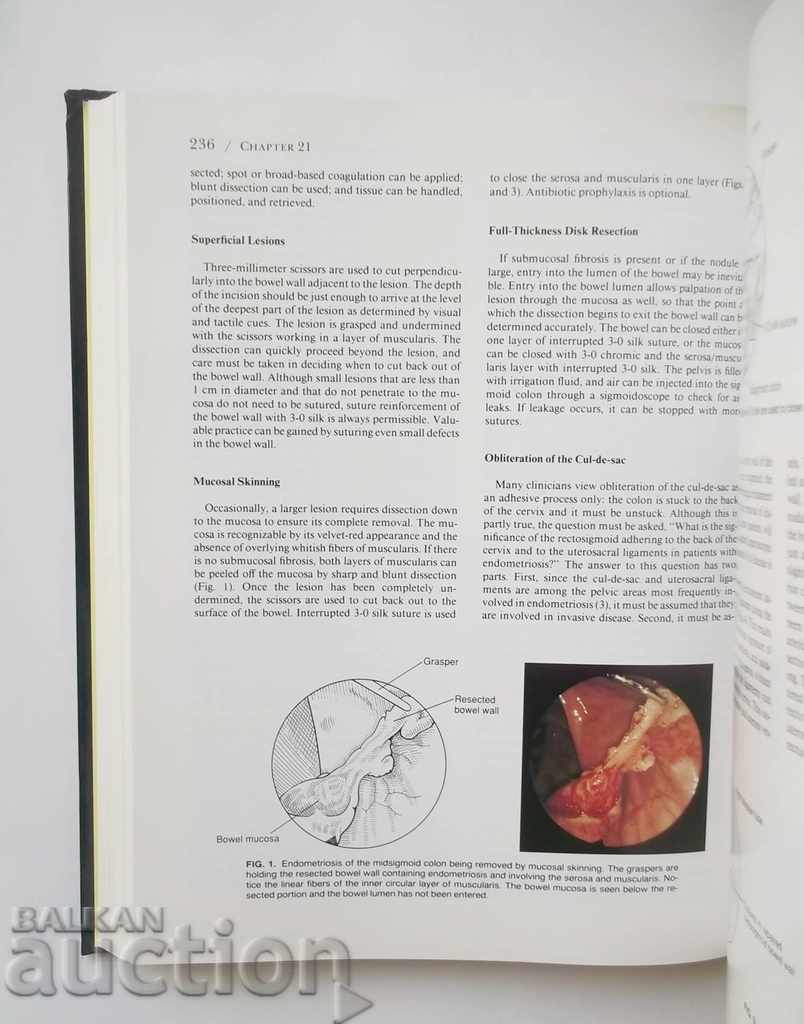 Endoscopic Management of Gynecologic Disease 1996 г. - 6 Endoscopic Management of Gynecologic Disease 1996 г. - 6