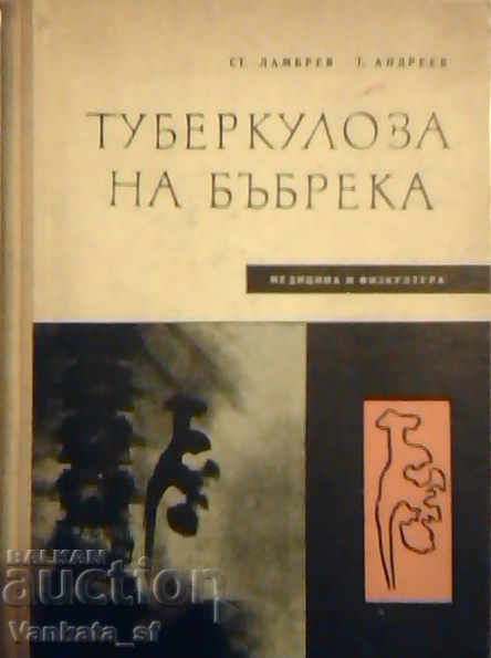 Φυματίωση του νεφρού - Σ. Λάμπρεβ, Τ. Αντρέεβ
