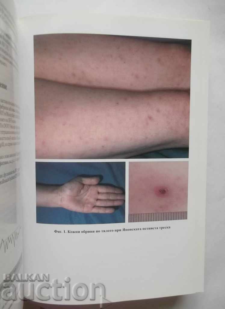 Auction Contemporary status of rickettsios in the world and in Bulgaria Auction Contemporary status of rickettsios in the world and in Bulgaria