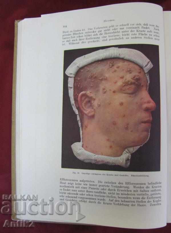 1923. Medical Book Germany Very Rare with price 180.00 BGN | € 92.03 1923. Medical Book Germany Very Rare with price 180.00 BGN | € 92.03