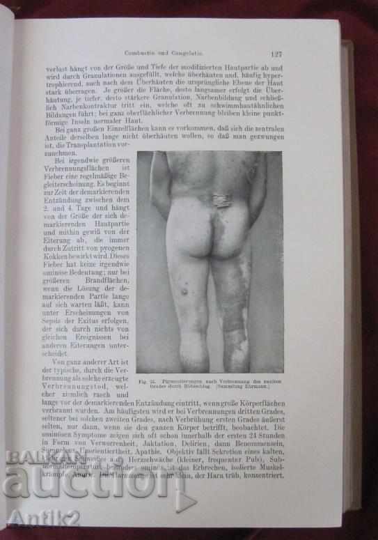 1923. Medical Book Germany Very Rare - 6 1923. Medical Book Germany Very Rare - 6