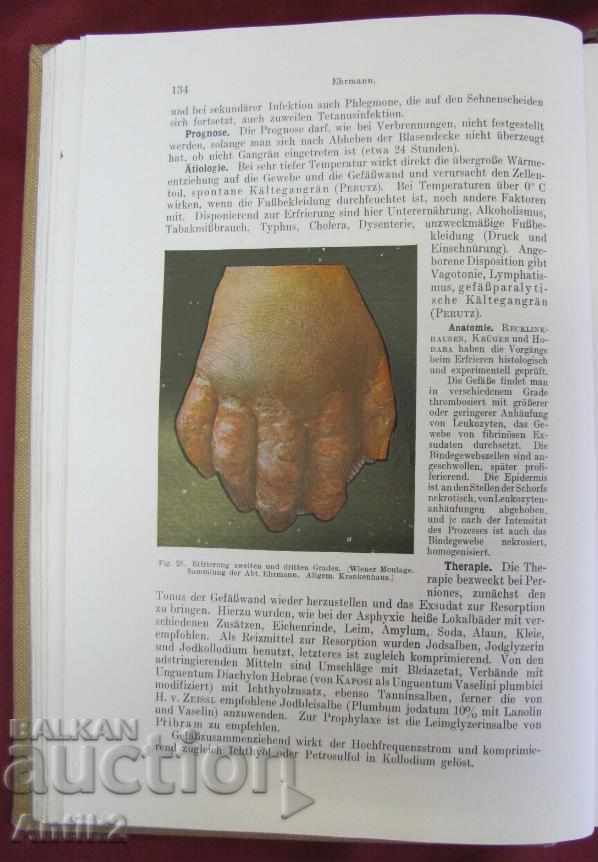 1923. Medical Book Germany Very Rare - 7 1923. Medical Book Germany Very Rare - 7