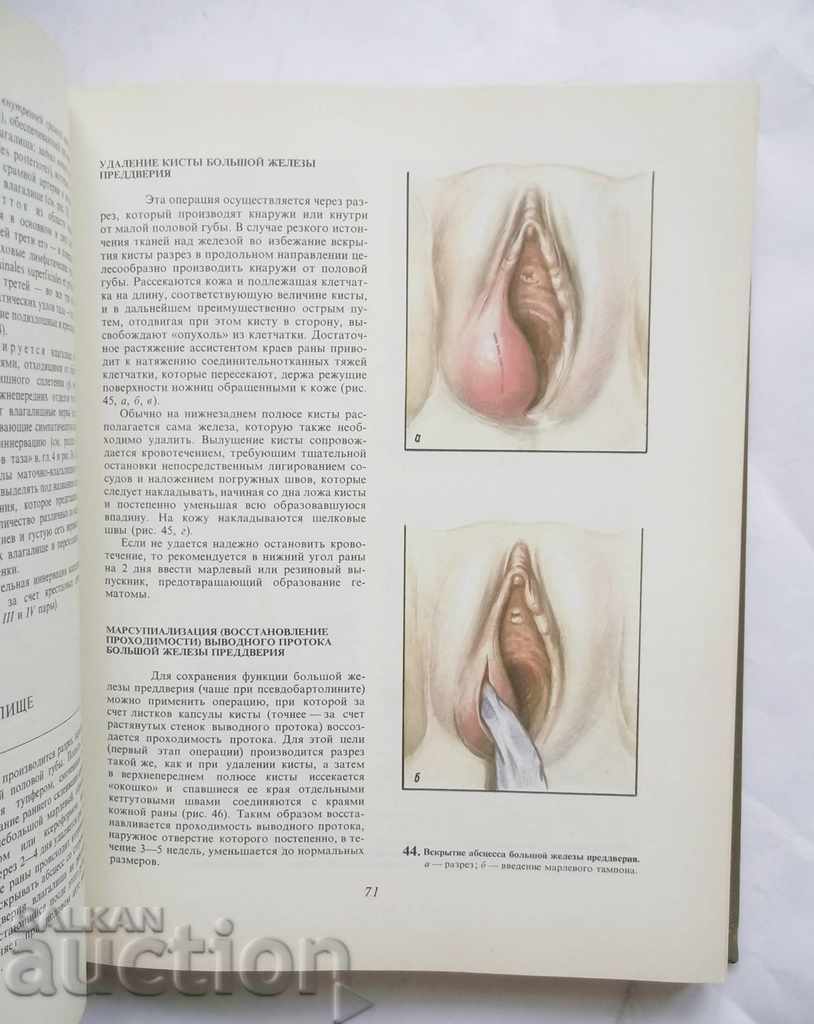 Auction Atlas Gynecological Operations - SS Davudov and others. 1979 Auction Atlas Gynecological Operations - SS Davudov and others. 1979