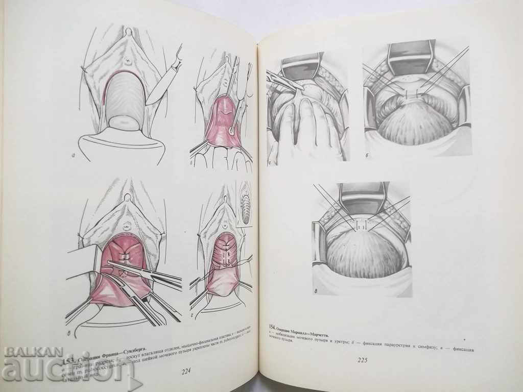 Delivery of Atlas Gynecological Operations - SS Davudov and others. 1979 Delivery of Atlas Gynecological Operations - SS Davudov and others. 1979