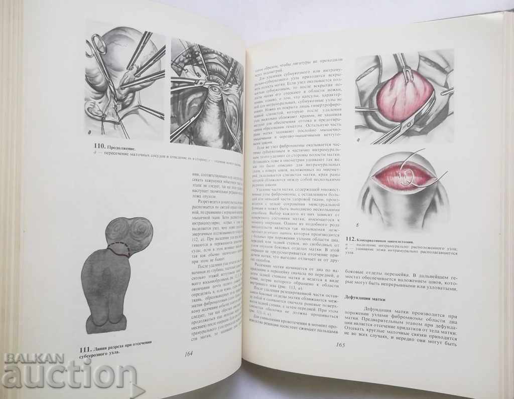 Atlas Gynecological Operations - SS Davudov and others. 1979 - 5 Atlas Gynecological Operations - SS Davudov and others. 1979 - 5