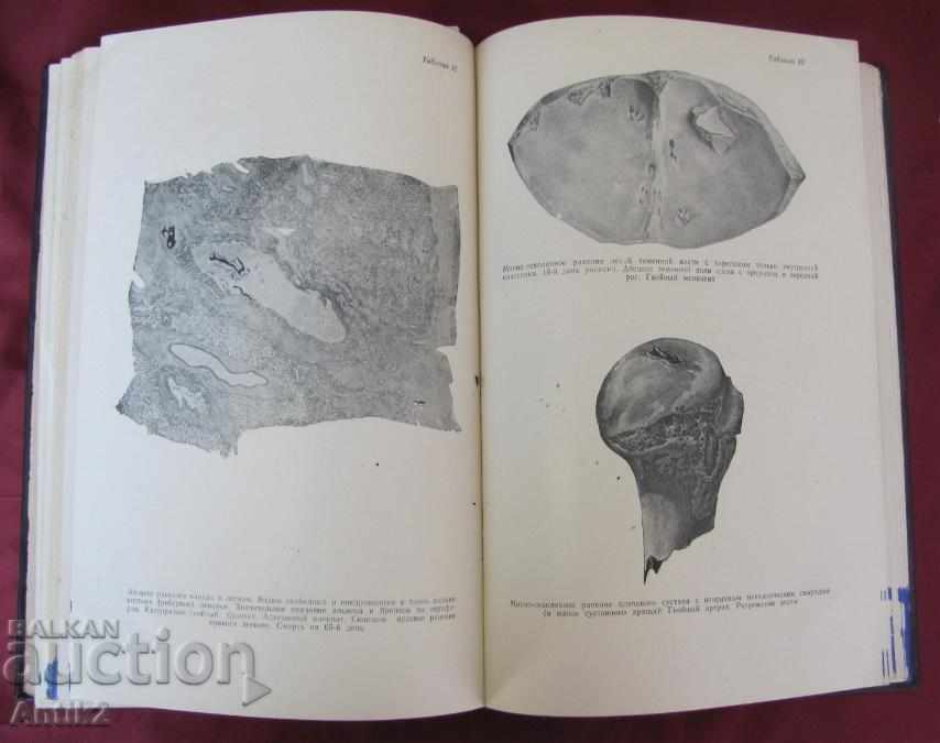 1952 Book of Fire Wounds of Man Tom 1 Moscow - 6 1952 Book of Fire Wounds of Man Tom 1 Moscow - 6