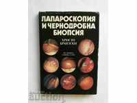 Λαπαροσκοπία και βιοψία ήπατος - Hristo Brailsky 1989