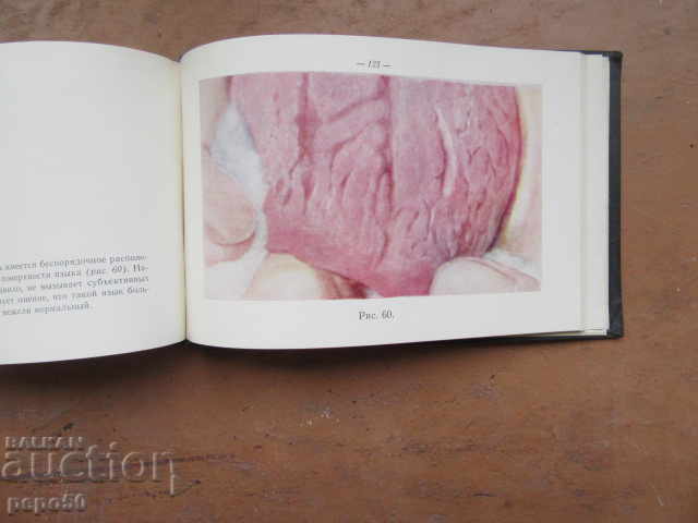 Diseases of the mucous membrane of the mouth-1960 - 6 Diseases of the mucous membrane of the mouth-1960 - 6