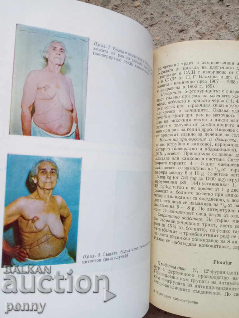 Clinical chemotherapy for malignant tumors - Ivan Hristov with price 10.00 BGN | € 5.11 Clinical chemotherapy for malignant tumors - Ivan Hristov with price 10.00 BGN | € 5.11