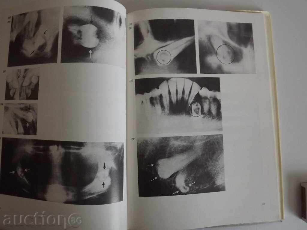 . ATLAS DENTAL X-ray DENTISTRY DENTIST DENTIST with price 15.00 BGN | € 7.67