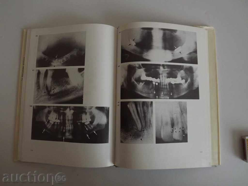 . ATLAS DENTAL X-ray DENTISTRY DENTIST DENTIST - 5