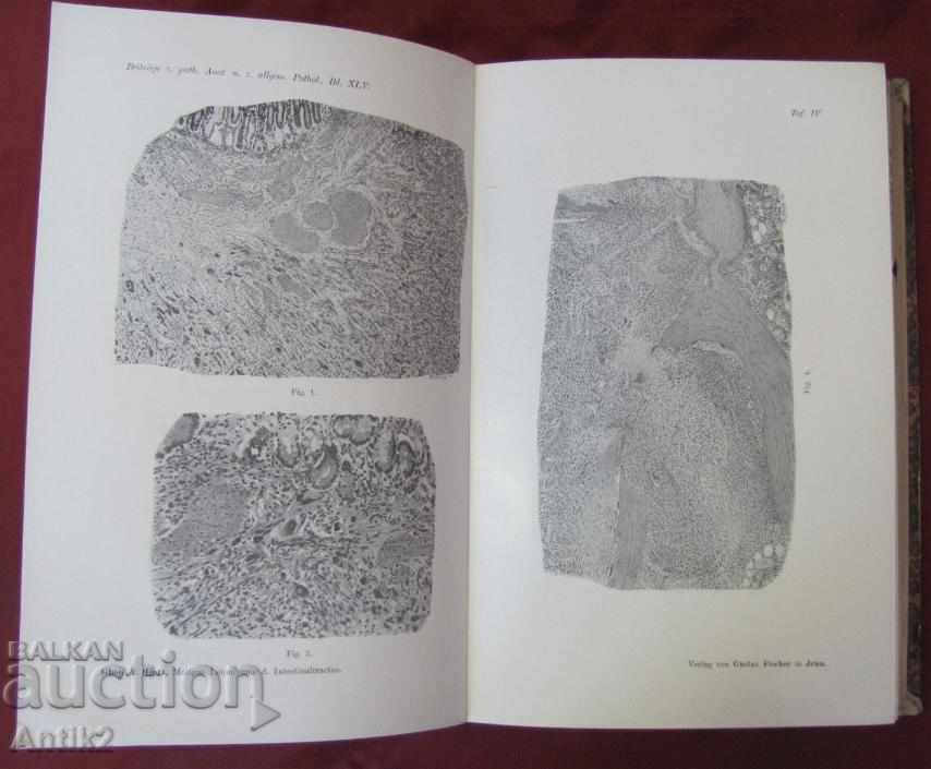 Delivery of 1909 Medical Book - Pathological Anatomy