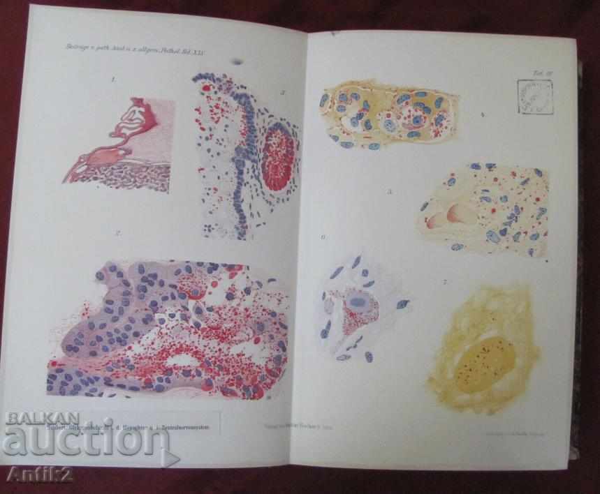1909 Medical Book - Pathological Anatomy - 5