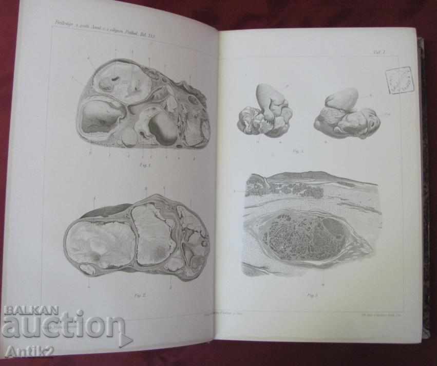 1909 Medical Book - Pathological Anatomy - 6