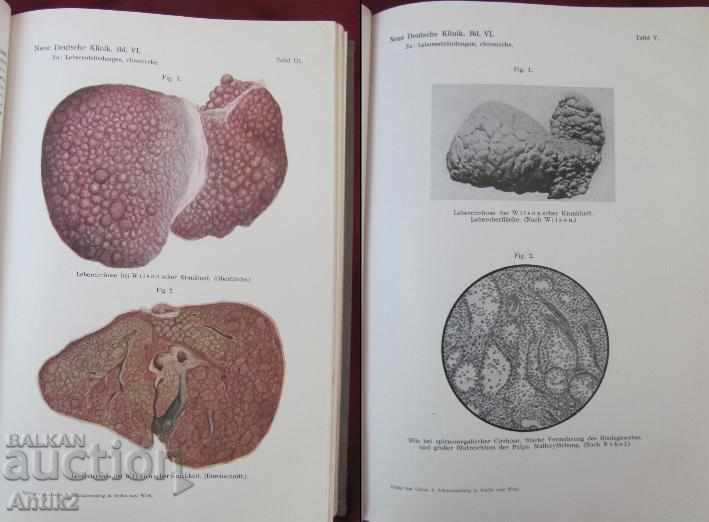 Auction  1930 Old Medical Book Germany