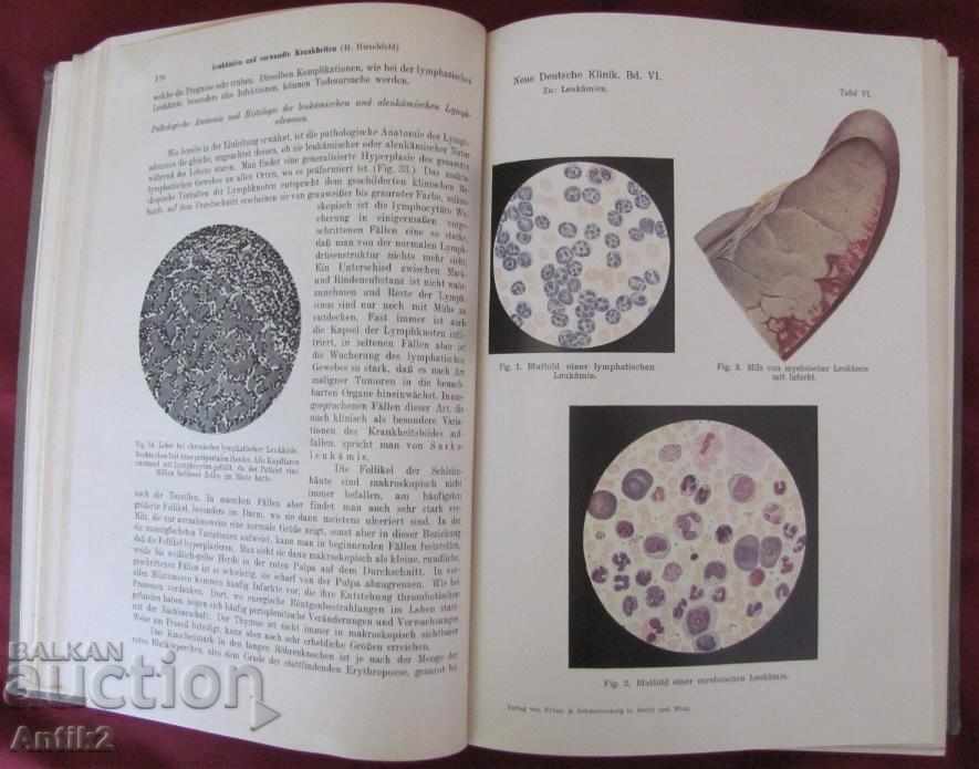 1930 Old Medical Book Germany - 5