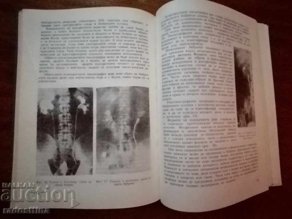 Delivery of Nephrolithiasis Century Lambrev and Eve. Victor Delivery of Nephrolithiasis Century Lambrev and Eve. Victor