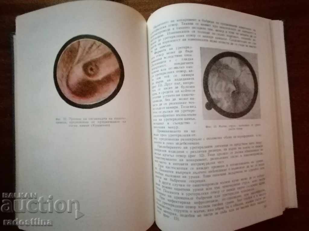 Nephrolithiasis Century Lambrev and Eve. Victor - 5 Nephrolithiasis Century Lambrev and Eve. Victor - 5