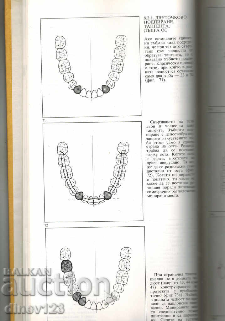 Auction PARTIAL DENTAL PROSTHESES WITH FOUNDATION - R. MARKSKORS Auction PARTIAL DENTAL PROSTHESES WITH FOUNDATION - R. MARKSKORS