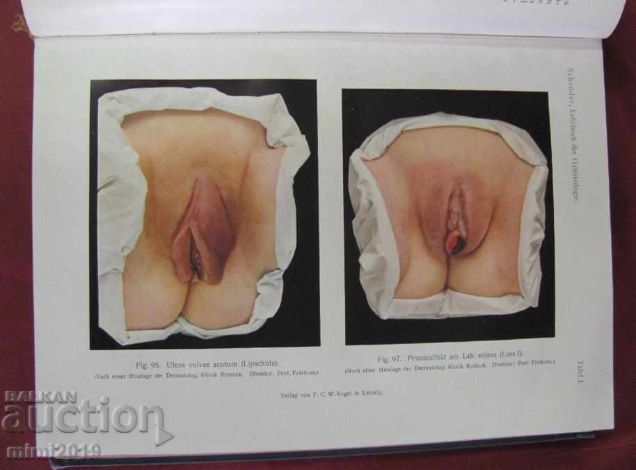 Аукцион 1922г. Книга Гинекология Германия Аукцион 1922г. Книга Гинекология Германия