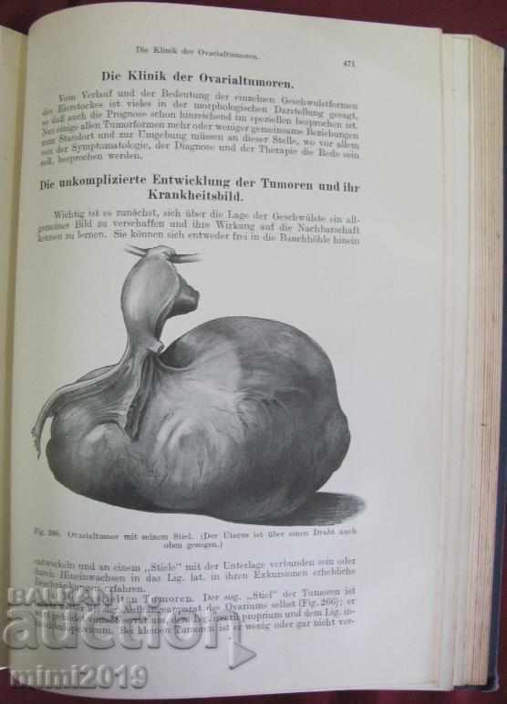 Доставка на 1922г. Книга Гинекология Германия Доставка на 1922г. Книга Гинекология Германия