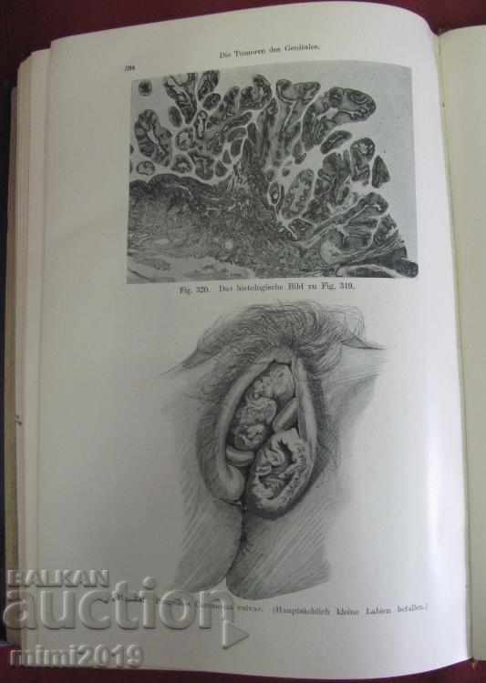 1922г. Книга Гинекология Германия - 6 1922г. Книга Гинекология Германия - 6