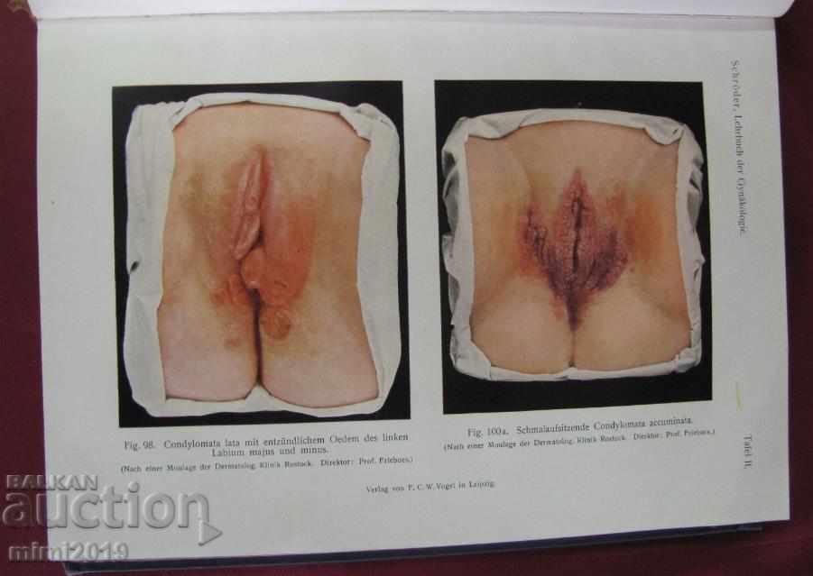 1922г. Книга Гинекология Германия - 7 1922г. Книга Гинекология Германия - 7