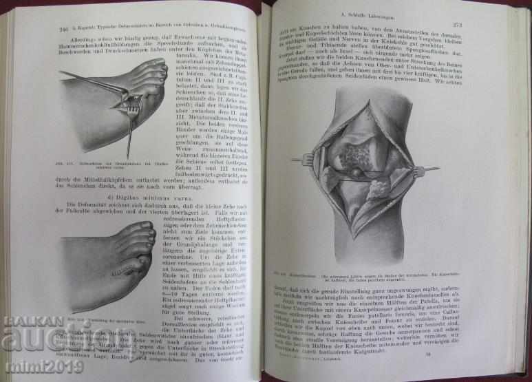 1925 Book Orthopadische Therapie Germany - 7 1925 Book Orthopadische Therapie Germany - 7