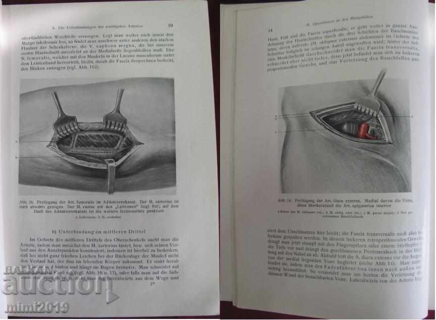 Δημοπρασία 1930 Βιβλιοθήκη Der Chirurgische Operationskursus Γερμανία Δημοπρασία 1930 Βιβλιοθήκη Der Chirurgische Operationskursus Γερμανία