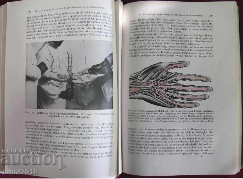 Παράδοση 1930 Βιβλιοθήκη Der Chirurgische Operationskursus Γερμανία Παράδοση 1930 Βιβλιοθήκη Der Chirurgische Operationskursus Γερμανία
