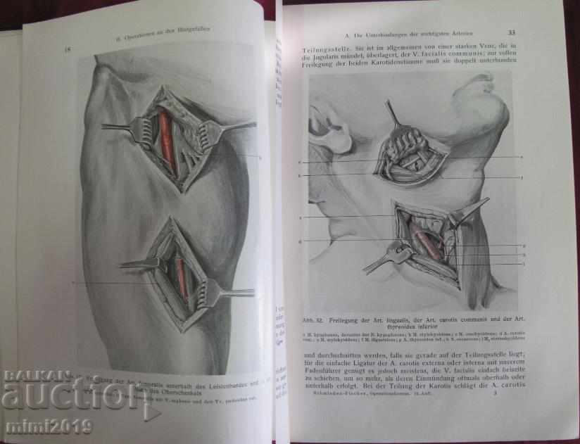 1930 Βιβλιοθήκη Der Chirurgische Operationskursus Γερμανία - 5 1930 Βιβλιοθήκη Der Chirurgische Operationskursus Γερμανία - 5