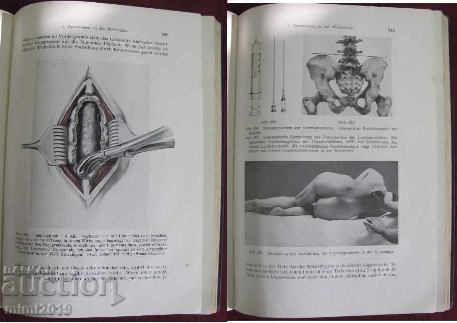 1930 Βιβλιοθήκη Der Chirurgische Operationskursus Γερμανία - 6 1930 Βιβλιοθήκη Der Chirurgische Operationskursus Γερμανία - 6